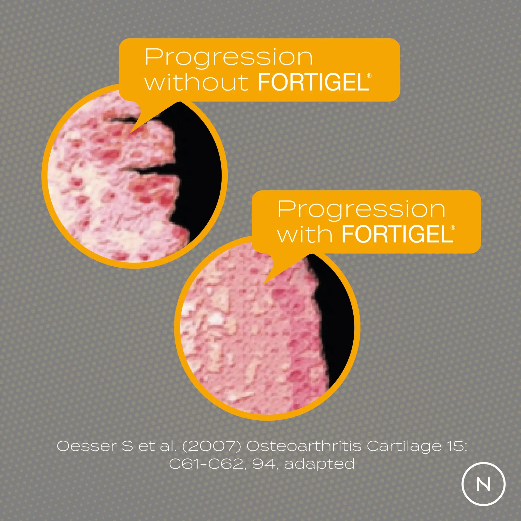 09 joint cartilage change image.jpg 09 joint cartilage change image.jpg